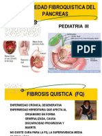 Fibrosis Quistica Pancreatica