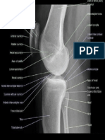 Labelled Lateral Knee