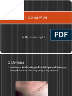Fibroma Mole dalam