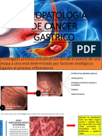 Fisiopatologia de Cancer Gastrico