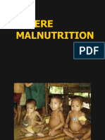 K13 - drQadri_Severe Malnutrition_ kuliah desember 2009.pptx