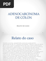 CA de Endométrio Ayder