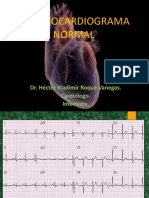 ECG Normal