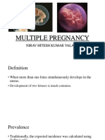 Multiple Pregnancy: Nirav Hitesh Kumar Valand