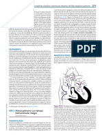 Atresia Pulmonar - Nelson