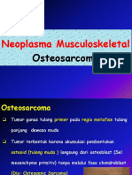 4. Osteosarcoma