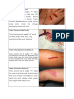 Jenis Luka Berdasarkan Penyebabnya