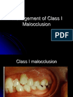 Class I Malocclusion