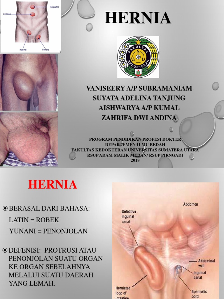 Panduan Lengkap tentang Hernia Medis | PDF