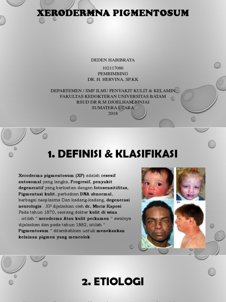 Xeroderma Pigmentosum | PDF | Kesehatan Holistik | Sains & Matematika