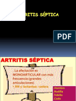 Artritis Septica Plus Medica