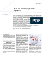 paralisis facial.pdf