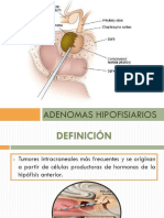 Adenoma Hipofisiario