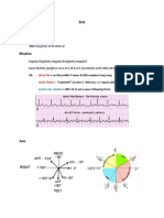 ECG Demographics Rate: 300/# Large Box in RR Interval