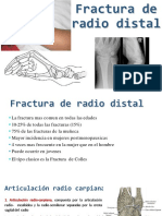 fractura de radio distal.pptx