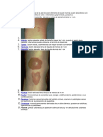 Lesiones Primarias y Secundarias