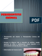 13 Periodontitis Crónica