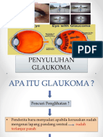 Penyuluhan Glaukoma Kld3