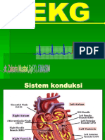 EKG 