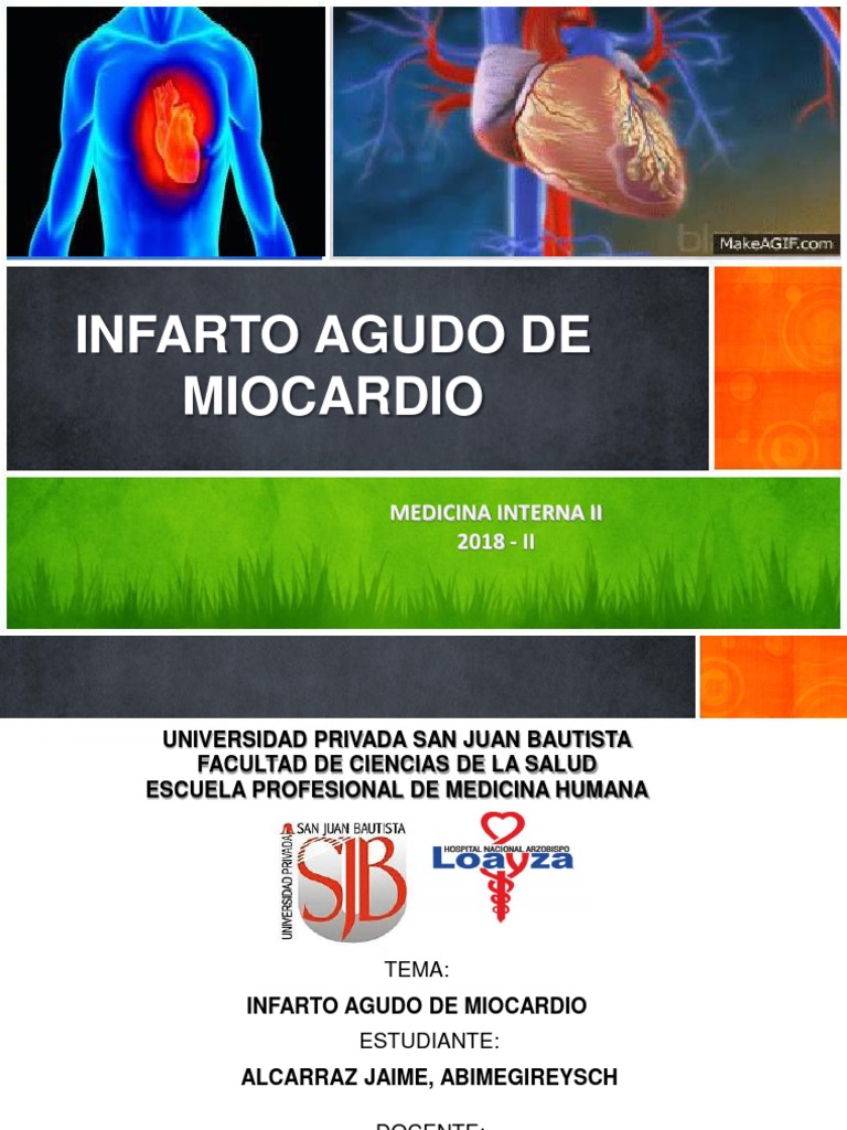 Infarto Agudo de Miocardio | PDF | Infarto de miocardio | Aterosclerosis