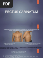 PECTUS CARINATUM