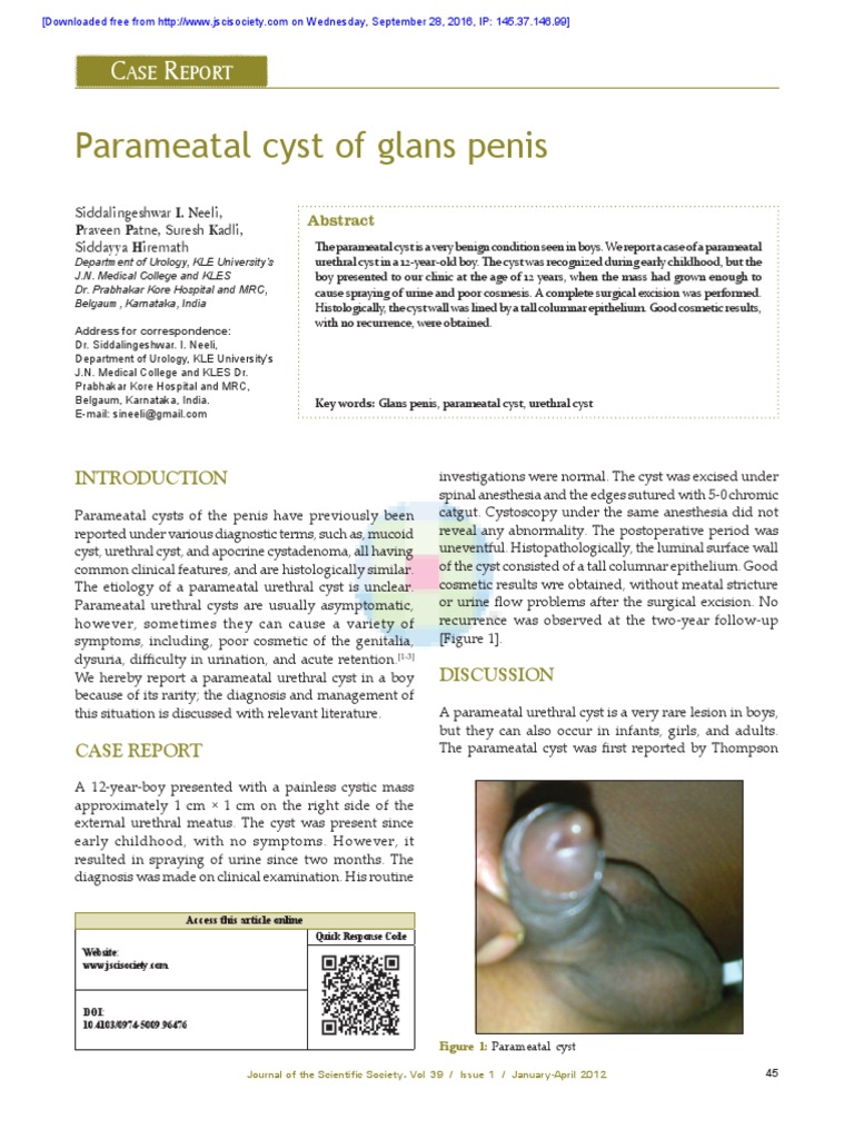 Parameatal Cyst of Glans Penis PDF Medical Diagnosis Ios
