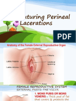 Suturing Perineal Lacerations