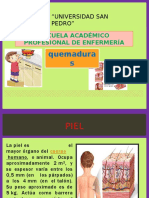EDITH QUEMADURAS.pptx