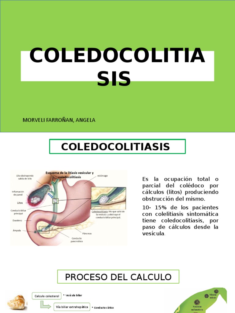 Fisiopatología y Tratamiento de Coledocolitiasis | PDF | Vesícula ...