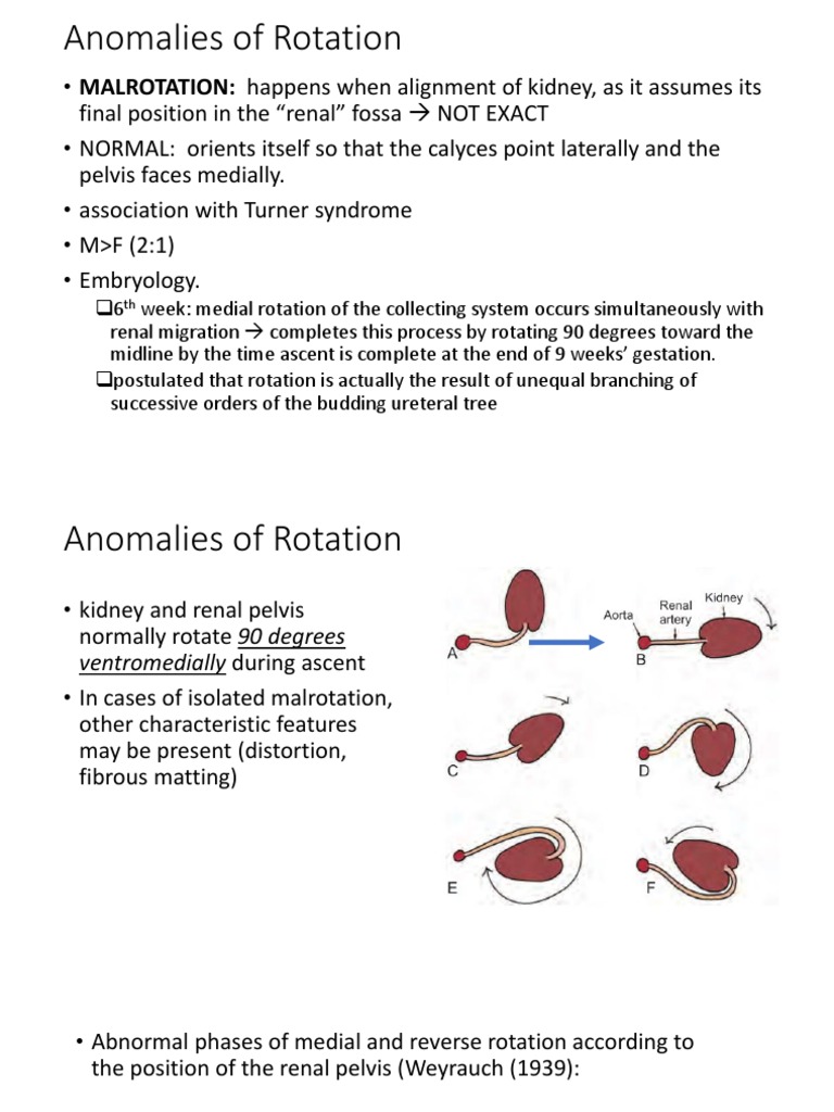 Anomalies of Rotation To CD | PDF | Kidney | Angiography