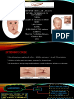 DIAPOSITIVAS_LABIO LEPORINO_QUEZADA GAVINO ANDERSON.pdf