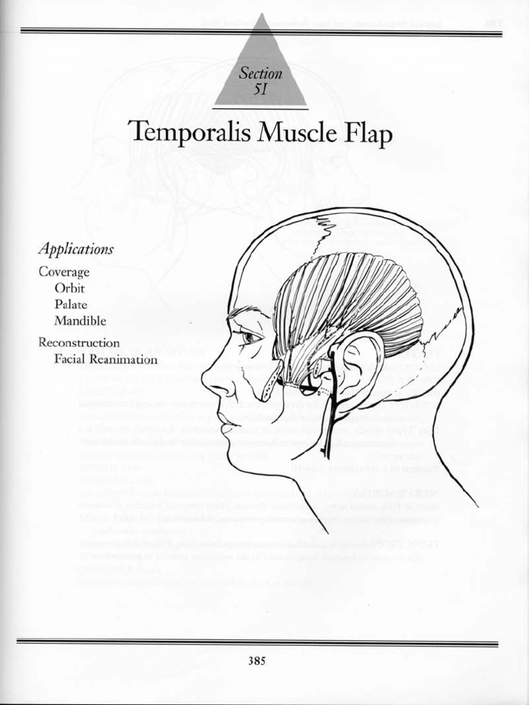 5I - Temporalis Muscle Flap | PDF