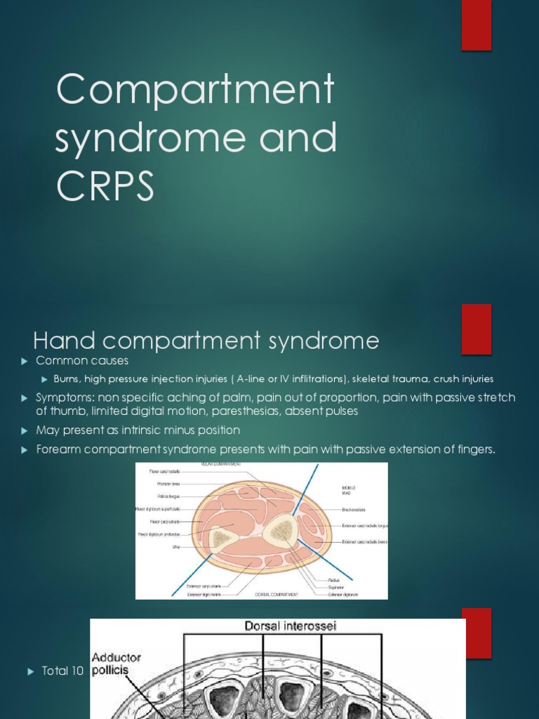 CRPS and Compartment Syndrome PDF Clinical Medicine Medical
