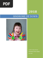 Sindrome Down