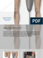 Amputasi Atas Lutut