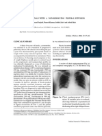 Nonresolving PF Sarcoidosis