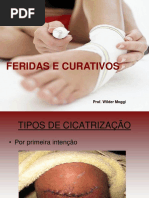 Feridas e Curativos