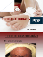 Feridas e Curativos