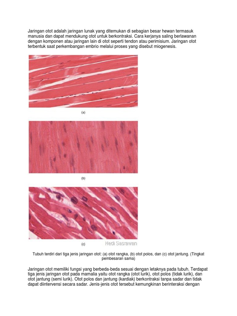 Perbedaan Otot Polos Otot Jantung Dan Otot Lurik Dalam Bentuk Tabel Tips Membedakan