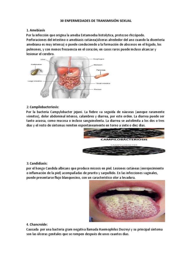 30 Enfermedades de Transmision Sexual Diarrea Infección transmitida
