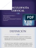 Radiculopatía Cervical