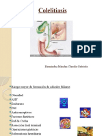 Colelitiasis