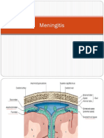 Meningitis