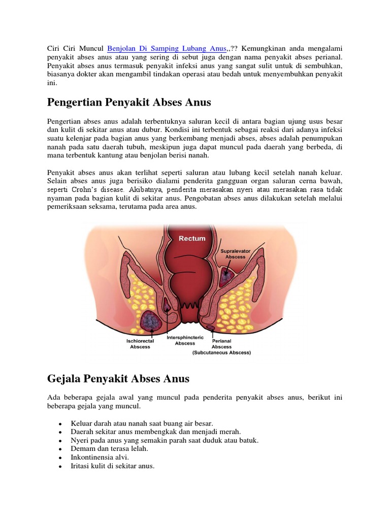 Ciri Ciri Muncul Benjolan Di Samping Lubang Anus Pdf