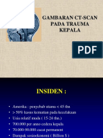 Gambaran Ct-Scan Trauma Kepala