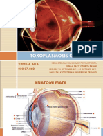 Toxoplasmosis Okular