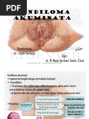 Onamning dosti video