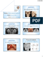 Anatomia da cabeça: fraturas, nervos e ossos do crânio