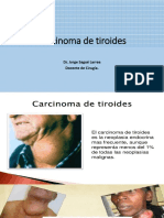 Carcinoma de Tiroides