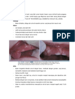 Epulis Congenital